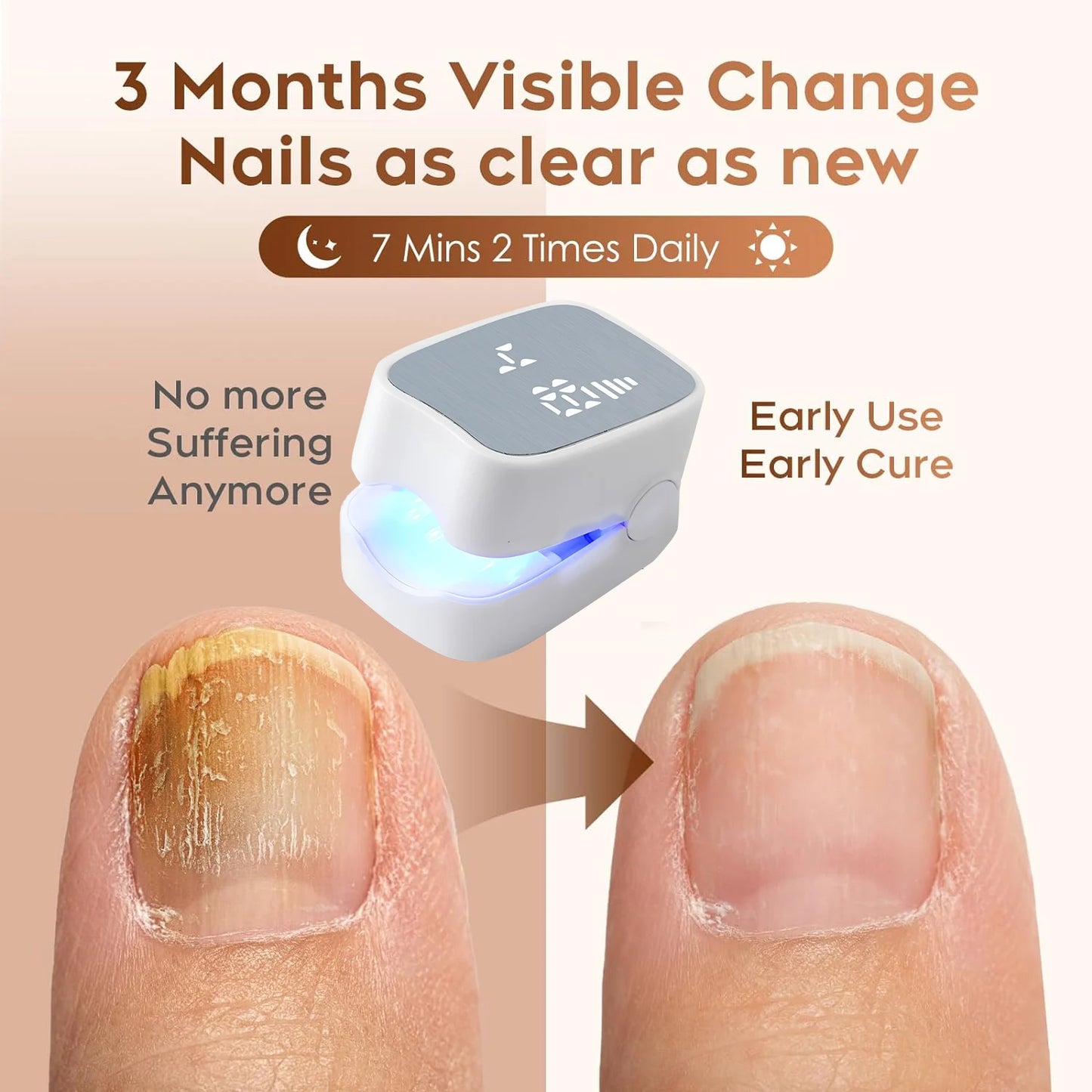 Rechargeable Laser Nail Fungus Remover Device