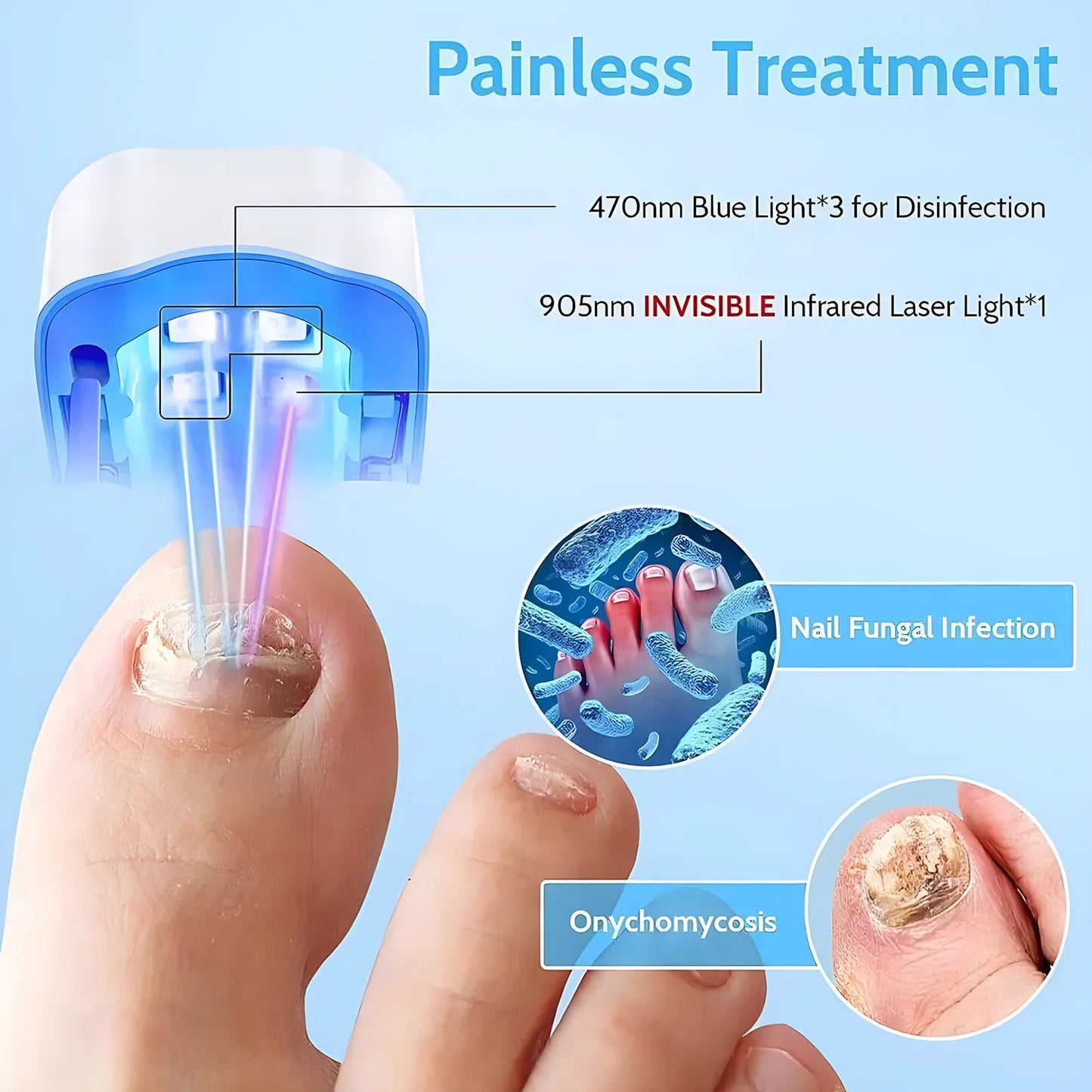 Rechargeable Laser Nail Fungus Remover Device